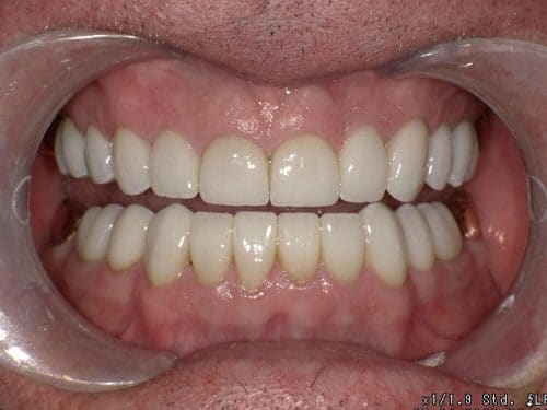 After treatment at Oakland Family Dental